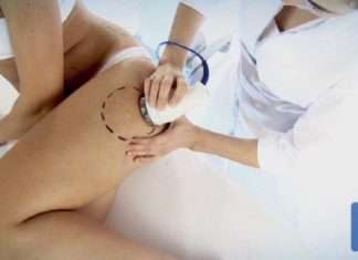 Кавітація – безопераційна корекція фігури та ваги