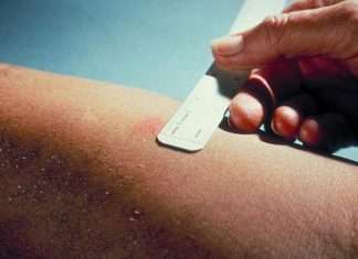 Чому не варто боятися реакції Манту