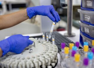 Кардашьяны и тайна вечной молодости: в погоне за биологическим возрастом