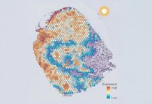 Une percée de l’IA identifie les types de cellules cancéreuses cachées, ouvrant la voie à des thérapies ciblées
