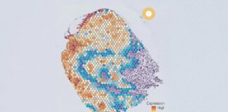 Прорив ШІ: виявлення прихованих типів ракових клітин, відкриття шляху до цільової терапії